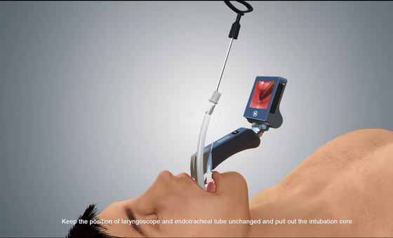 HD Taşınabilir USB Video Laringoskop Yetişkin Pediatrik Haiye Medical