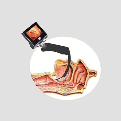 Yetişkin Çocuk Bebek için Kör Alan Kamera Haiye Video Laringoskop Borescope