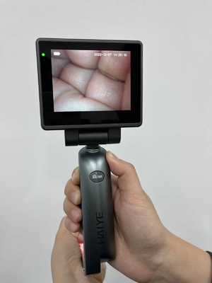 3.0 İnç HD Görüntülü Tıbbi Video Laringoskop - Entübasyon Videosu Laringoskop