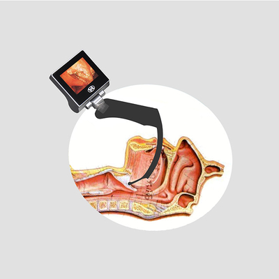 USB 32GB Anestezi Elde Taşınabilir Video Laringoskop HYHJ-KC