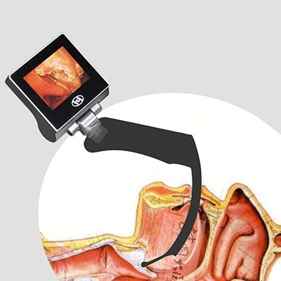 360 Derece LCD Yeniden Kullanılabilir Anestezi Video Laringoskop 2 Milyon Piksel