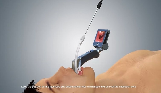 Pediatri için Anti Mikrobiyal Tıbbi Video Laringoskop Ekipmanı 1280 X 720 Piksel