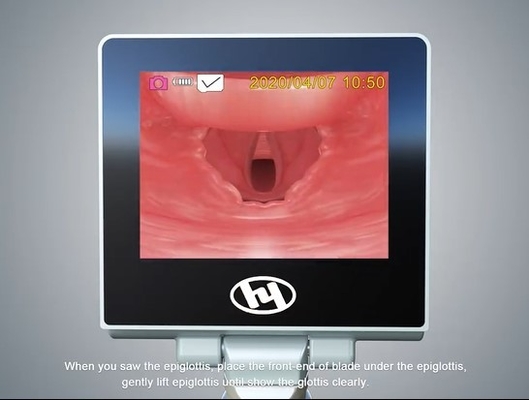 960*480 Video Entübasyon Cihazları Video Laringoskop HYHJ-KC